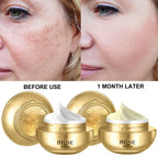 AILKE 24K Collagen Facial Whitening Set,